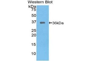 Western Blotting (WB) image for anti-TNF Receptor-Associated Factor 6 (TRAF6) (AA 153-423) antibody (ABIN1860861) (TRAF6 antibody  (AA 153-423))