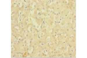 Immunohistochemistry of paraffin-embedded human liver tissue using ABIN7143220 at dilution of 1:100 (Diazepam Binding Inhibitor antibody  (AA 2-105))