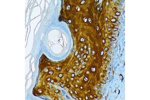 Immunohistochemistry (IHC) image for anti-Keratin 1 (KRT1) antibody (ABIN7268085)