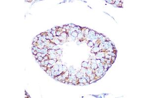 Immunohistochemistry of paraffin-embedded rat testis using Muscarinic AChR M2 (Muscarinic AChR M2 ) Rabbit mAb (ABIN7266346) at dilution of 1:100 (40x lens). (Muscarinic Acetylcholine Receptor M2 antibody)