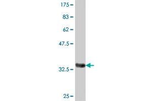 Western Blot detection against Immunogen (38. (SOS2 antibody  (AA 312-420))