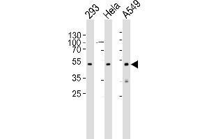 Western blot analysis of lysates from 293, Hela, A549 cell line (from left to right), using CBX8 Antibody (C-term) (ABIN6242216 and ABIN6577075). (CBX8 antibody  (C-Term))