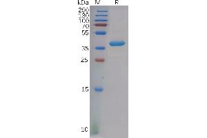 Platelet Factor 4 (PF4) (AA 32-101) protein (Fc Tag)