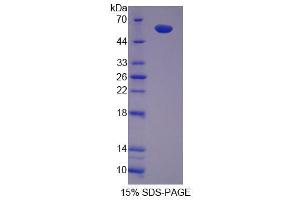 Image no. 1 for IL2-Inducible T-Cell Kinase (ITK) (AA 368-625) protein (His tag,GST tag) (ABIN4990733)