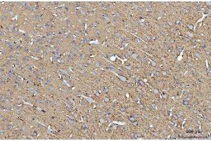 IHC analysis of ATP1B1 using anti-ATP1B1 antibody (ABIN7602014).