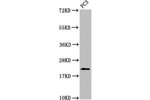 Western Blot Positive WB detected in: PC-3 whole cell lysate All lanes: HIST1H1D antibody at 1 μg/mL Secondary Goat polyclonal to rabbit IgG at 1/50000 dilution Predicted band size: 23 kDa Observed band size: 23 kDa (Histone H1.3 antibody  (pThr146))