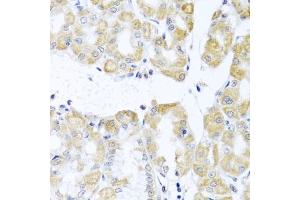 Immunohistochemistry of paraffin-embedded human stomach using DDX39A antibody (ABIN6131590, ABIN6139489, ABIN6139491 and ABIN6223963) at dilution of 1:100 (40x lens).