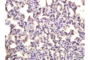 Immunohistochemistry (Paraffin-embedded Sections) (IHC (p)) image for anti-Toll-Like Receptor 3 (TLR3) (AA 801-905) antibody (ABIN686617)