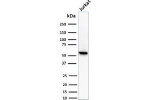 Western Blot Analysis of human Jurkat cell lysate using Topo I, MT Mouse Monoclonal Antibody (TOP1MT/488). (TOP1MT antibody)