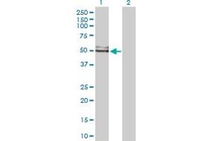 Western Blot analysis of GDI1 expression in transfected 293T cell line by GDI1 MaxPab polyclonal antibody. (GDI1 antibody  (AA 1-447))