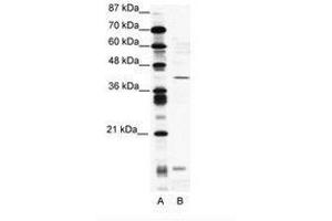 Image no. 1 for anti-CAMP Responsive Element Modulator (CREM) (AA 19-68) antibody (ABIN202021)