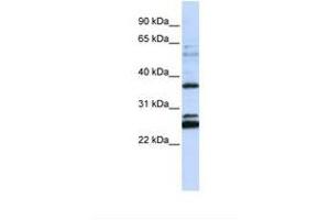Image no. 1 for anti-Family with Sequence Similarity 70, Member A (FAM70A) (AA 108-157) antibody (ABIN6738344) (FAM70A antibody  (AA 108-157))