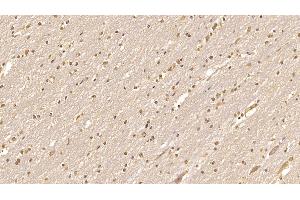 Immunohistochemistry (IHC) image for anti-Cerebral Dopamine Neurotrophic Factor (CDNF) (AA 33-187) antibody (ABIN7427180)