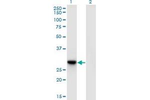 Western Blot analysis of DNAJC27 expression in transfected 293T cell line by DNAJC27 monoclonal antibody (M09), clone 3C1.