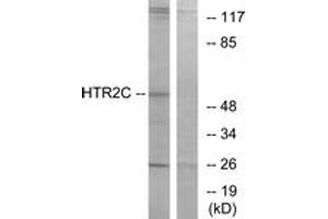 Western blot analysis of extracts from Jurkat cells, using HTR2C Antibody. (HTR2C antibody  (AA 395-444))