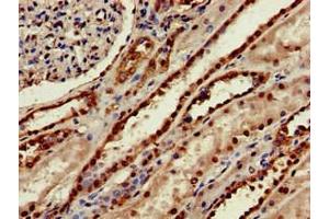 Immunohistochemistry of paraffin-embedded human kidney tissue using ABIN7159597 at dilution of 1:100 (MSRB1 antibody  (AA 1-116))
