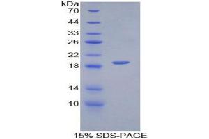 SDS-PAGE analysis of Mouse PECAM1 Protein. (CD31 Protein)