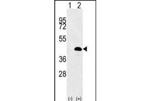 Western blot analysis of LUC7L (arrow) using rabbit polyclonal LUC7L Antibody (Center) (ABIN656137 and ABIN2845476).