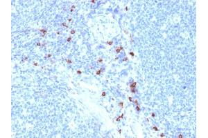 Formalin-fixed, paraffin-embedded human Tonsil stained with Tryptase Mouse Monoclonal Antibody (TPSAB1/1963).