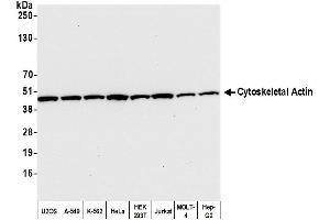 Western Blotting (WB) image for anti-Cytoskeletal Actin (CIMG_00972) (N-Term) antibody (ABIN7453594) (Cytoskeletal Actin (CIMG_00972) (N-Term) antibody)