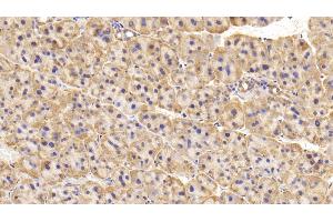 Detection of TH in Rat Adrenal gland Tissue using Polyclonal Antibody to Tyrosine Hydroxylase (TH) (Tyrosine Hydroxylase antibody  (AA 34-301))