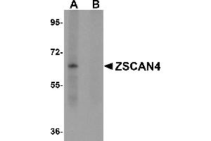 Western Blotting (WB) image for anti-Zinc Finger and SCAN Domain Containing 4 (ZSCAN4) (C-Term) antibody (ABIN1030831) (ZSCAN4 antibody  (C-Term))