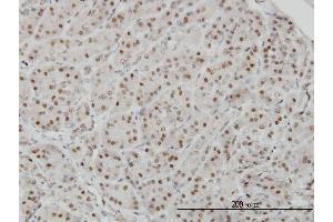 Immunoperoxidase of monoclonal antibody to AKAP8 on formalin-fixed paraffin-embedded human pancreas.