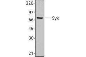 Western Blotting (WB) image for anti-Spleen tyrosine Kinase (SYK) (AA 5-360) antibody (ABIN2665374) (SYK antibody  (AA 5-360))
