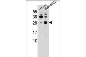 CBLN2 Antibody (C-term) (ABIN655780 and ABIN2845215) western blot analysis in mouse brain tissue and MDA-M cell line lysates (35 μg/lane). (CBLN2 antibody  (C-Term))
