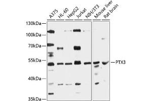 Western blot analysis of extracts of various cell lines, using PTX3 antibody (ABIN6129313, ABIN6146488, ABIN6146490 and ABIN6216395) at 1:3000 dilution. (PTX3 antibody  (AA 18-240))