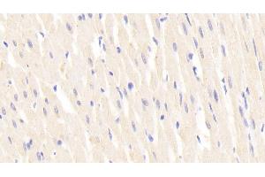 Detection of LAMb2 in Rat Cardiac Muscle Tissue using Polyclonal Antibody to Laminin Beta 2 (LAMb2) (LAMB2 antibody  (AA 939-1129))