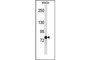 Western blot analysis of LZTS2 Antibody (LZTS2 antibody  (C-Term))