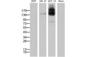 Image no. 1 for anti-ATP-Binding Cassette, Sub-Family B (MDR/TAP), Member 1 (ABCB1) (AA 995-1280) antibody (ABIN1491730) (ABCB1 antibody  (AA 995-1280))