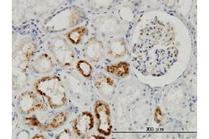 Immunohistochemistry (Formalin-fixed Paraffin-embedded Sections) (IHC (fp)) image for anti-Metalloproteinase Inhibitor 2 (TIMP2) (AA 27-220) antibody (ABIN948564)