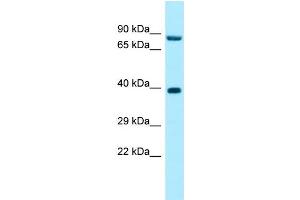 WB Suggested Anti-RPP30 Antibody Titration: 1. (RPP30 antibody  (C-Term))