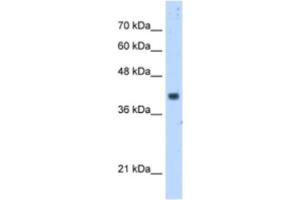Western Blotting (WB) image for anti-Prenyl (Decaprenyl) Diphosphate Synthase, Subunit 1 (PDSS1) antibody (ABIN2462955)
