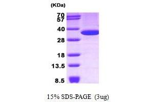 Figure annotation denotes ug of protein loaded and % gel used. (Annexin V Protein (AA 1-320))