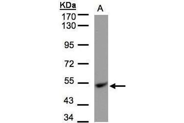 UQCRC1 antibody