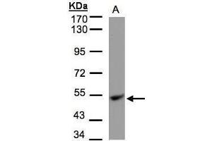 WB Image Sample(30 μg of whole cell lysate) A:Hep G2, 7. (UQCRC1 antibody)