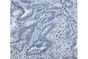 IHC analysis of MRE11 using anti-MRE11 antibody (ABIN7600025). (Mre11 antibody  (AA 14-481))