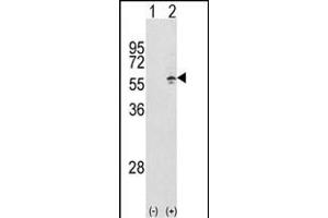 Western blot analysis of CCT3 (arrow) using rabbit polyclonal CCT3 Antibody (Center) (ABIN389422 and ABIN2839505). (CCT3 antibody  (AA 298-326))