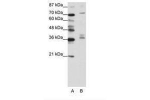 Image no. 1 for anti-A Kinase (PRKA) Anchor Protein (Yotiao) 9 (AKAP9) (N-Term) antibody (ABIN203051)