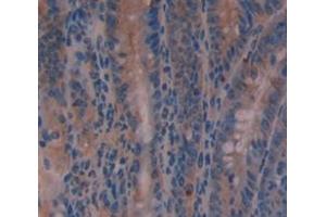 Figure. (TMPRSS2 antibody  (AA 254-490))