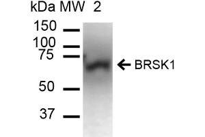 Western blot analysis of Mouse Brain cell lysates showing detection of ~85. (BRSK1 antibody  (Atto 390))