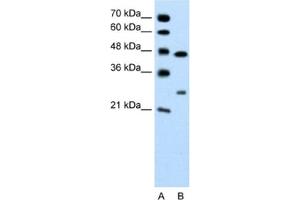 Western Blotting (WB) image for anti-Claudin 18 (CLDN18) antibody (ABIN2462406)