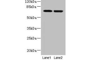 Western blot All lanes: NETO2 antibody at 4 μg/mL Lane 1: U251 whole cell lysate Lane 2: MDA-MB-231 whole cell lysate Secondary Goat polyclonal to rabbit IgG at 1/10000 dilution Predicted band size: 60, 23, 59 kDa Observed band size: 70 kDa