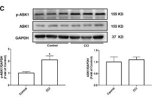Western Blotting (WB) image for anti-Mitogen-Activated Protein Kinase Kinase Kinase 5 (MAP3K5) (pThr845) antibody (ABIN683128)