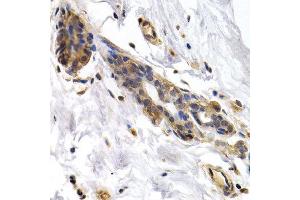 Immunohistochemistry of paraffin-embedded human normal breast using PKLR antibody at dilution of 1:200 (400x lens). (PKLR antibody)