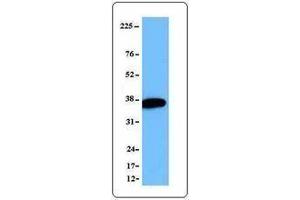 Western Blotting (WB) image for anti-Eukaryotic Translation Initiation Factor 3, Subunit I (EIF3I) antibody (ABIN2664945) (EIF3I antibody)