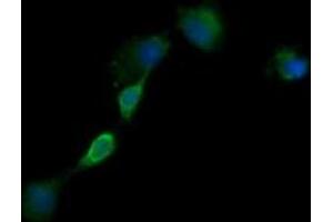 Image no. 2 for anti-Epidermal Growth Factor Receptor (EGFR) antibody (ABIN1497964) (EGFR antibody)